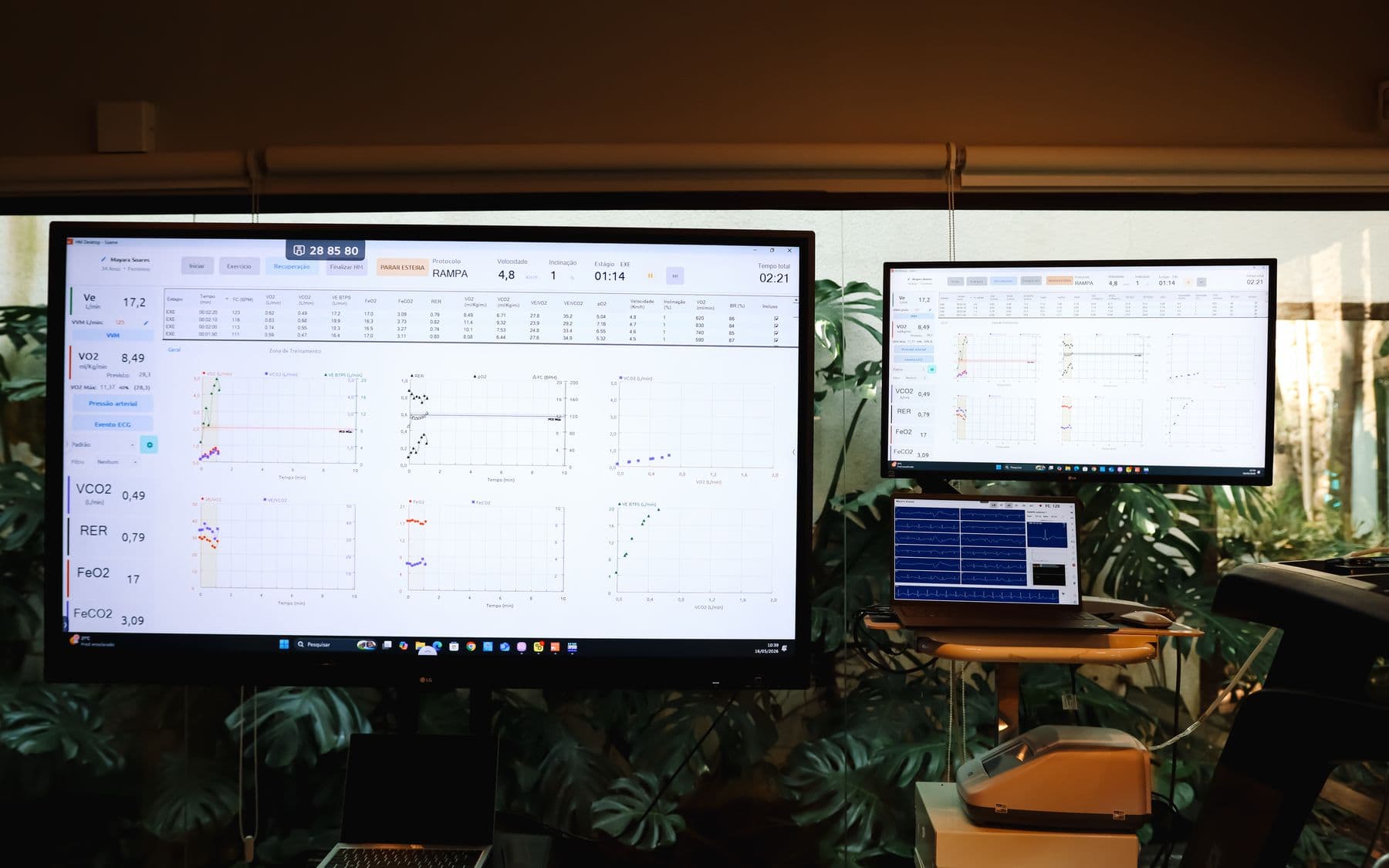 Monitores LG do laboratório Oxy Recovery exibindo gráficos em tempo real do teste cardiopulmonar — VO₂, VCO₂, RER, FeO₂ e FeCO₂ — com plantas tropicais ao fundo.